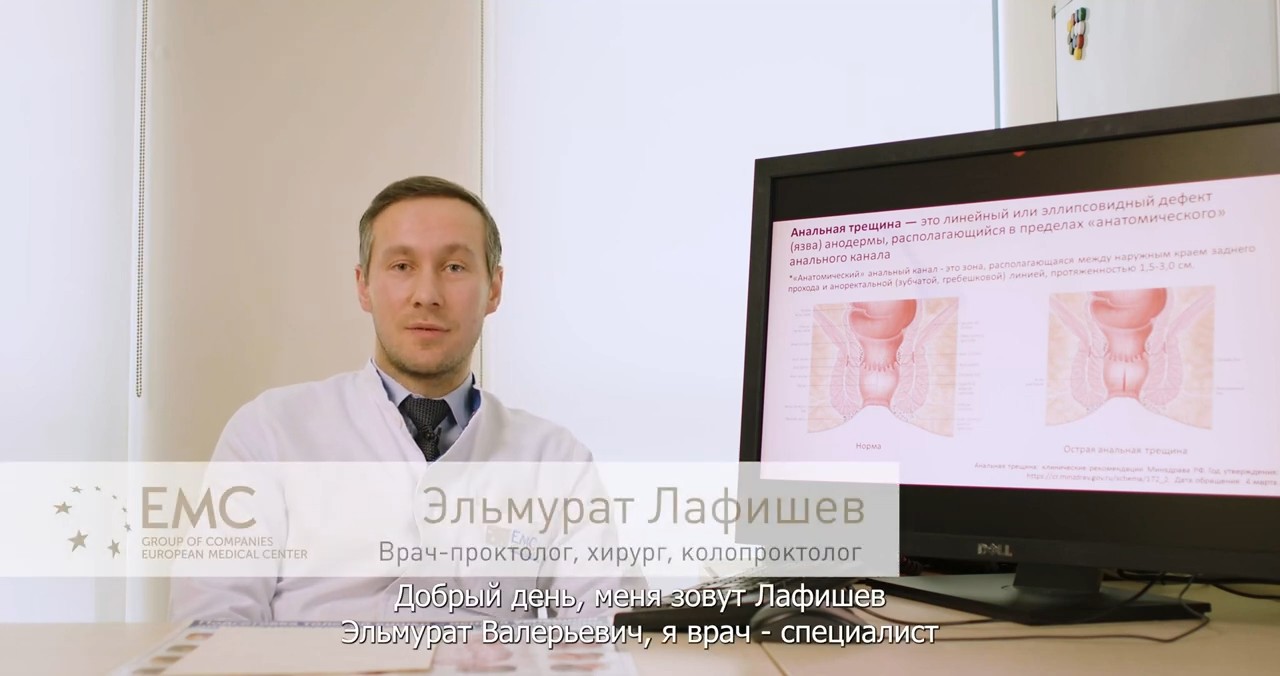 Анальная трещина: диагностика и лечение в ЕМС
