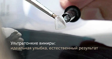 Ультратонкие виниры - новая технология для идеальной улыбки